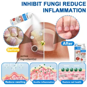 ADNOON Natural Magnesium Herbal Psoriasis Spray