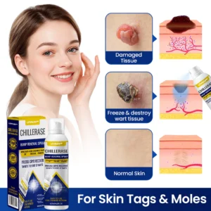 LOVILDS™ ChillErase Bump Renewal Spray image LOVILDS™ ChillErase Bump Renewal Spray