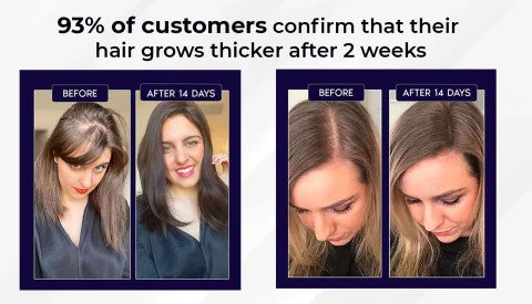 HZA™ Natural Hair Regrowth Spray