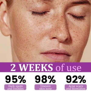 LOVILDS™ MelantraX Advanced Anti-Hyperpigmentation Essence