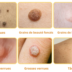 Flysmus™ TagRecede Bee Venom Treatment Spray