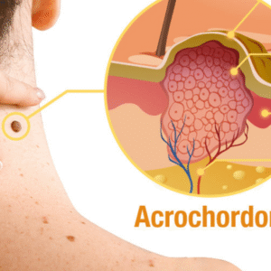 Flysmus™ TagRecede Bee Venom Treatment Spray