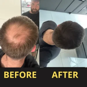 Slimoly™ Hair & Scalp Concealer 50ML