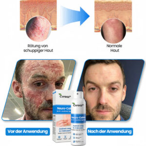 Cvreoz® Neuro-Calm Anti-Itch Acute Spray image Cvreoz® Neuro-Calm Anti-Itch Acute Spray