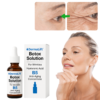 DermaLift™ Botox Soliton For Wrinkles Hyarulonic Acid