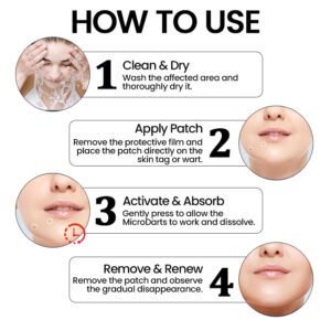 KUBOZN® Pro MicroDarts TAG'Gone Patch