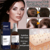 LOVILDS Natural Hair Regrowth Spray image LOVILDS Natural Hair Regrowth Spray