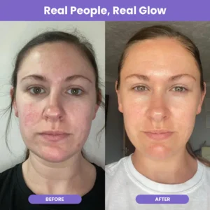 NutraGlow Multi Collagen Anti-Aging Blend