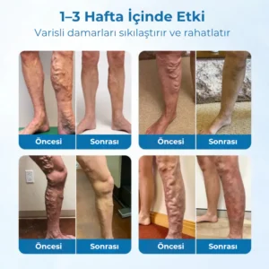 Timilk® VeinGuard Herbal Spray