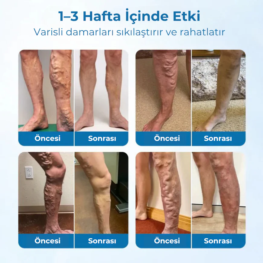 Timilk® VeinGuard Herbal Spray