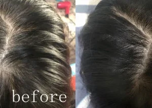 Lovilds® Hair Restoration Spray