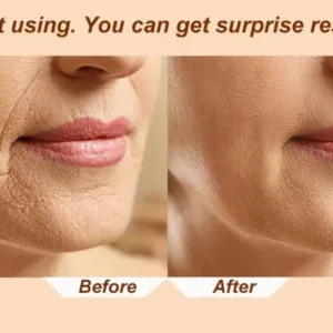 Electric Facial Massage Roller