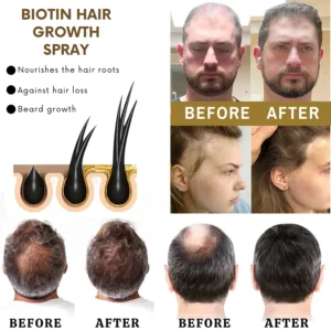 VitaGrow™ Spray | Stop hair loss and regrow up to 99% of your hair in just 2-3 weeks!