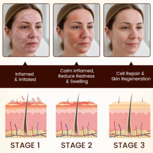 Biancat® Bee Venom Multi-Repair Cream