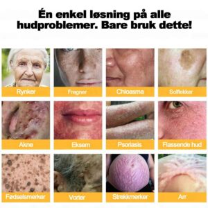 BeeRx™ Skin Cream | Break out of the endless cycle of failed creams, strong steroids and empty promises