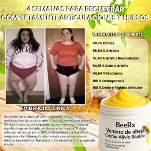 BeeRx | Bee Venom Cream for Bones and Joints image BeeRx | Bee Venom Cream for Bones and Joints