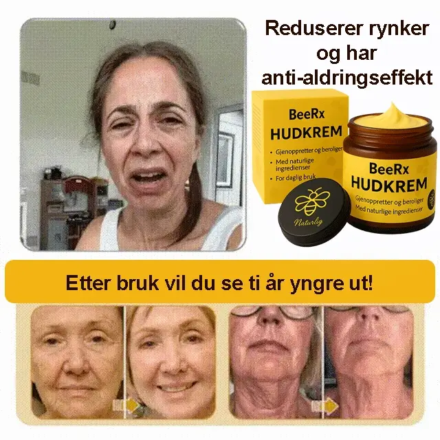 BeeRx™ Skin Cream | Break out of the endless cycle of failed creams, strong steroids and empty promises - Image 2