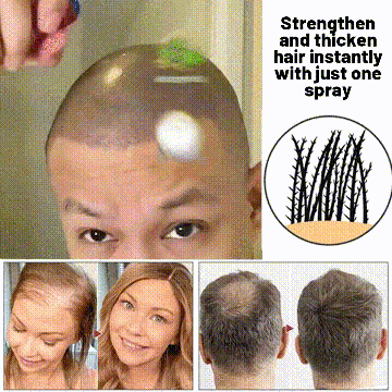 HZA™ Natural Hair Regrowth Spray