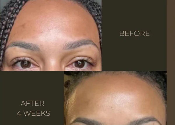 ReviveTonic™Kojic Acid Facial Cleanser