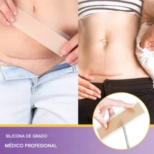 Oveallgo® RejuveSkin Tape