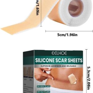 EELHOE Silicone Scar Sheets!