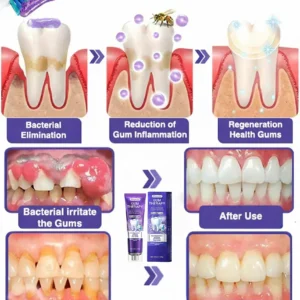 Alisanda® Bee Venom Dental Treatment Toothpaste image Alisanda® Bee Venom Dental Treatment Toothpaste