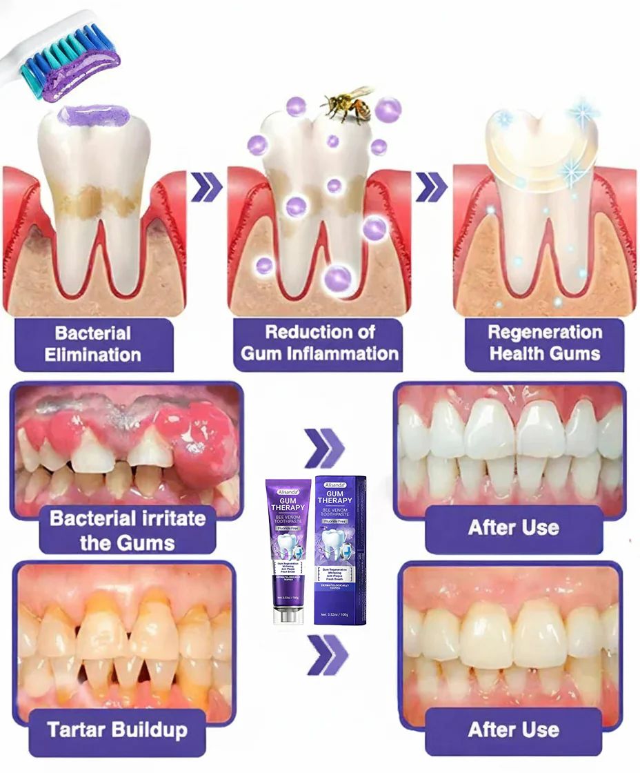 Alisanda® Bee Venom Dental Treatment Toothpaste image Alisanda® Bee Venom Dental Treatment Toothpaste