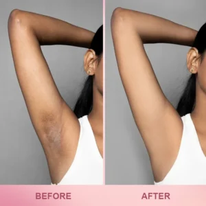 LIMETOW™ Whitening Skin Stick image LIMETOW™ Whitening Skin Stick