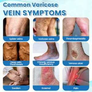 GFOUK® VascuCare Vein Healing Spray