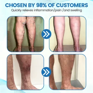 GFOUK® VascuCare Vein Healing Spray