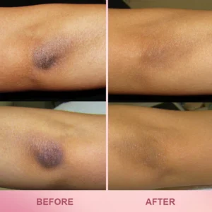 LIMETOW™ Whitening Skin Stick image LIMETOW™ Whitening Skin Stick