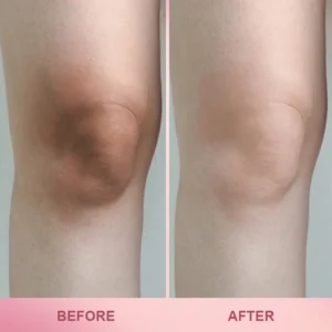 LIMETOW™ Whitening Skin Stick image LIMETOW™ Whitening Skin Stick