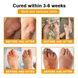 Purelora® Bee Venom Lithospermum Pain-Relief Cream image Purelora® Bee Venom Lithospermum Pain-Relief Cream