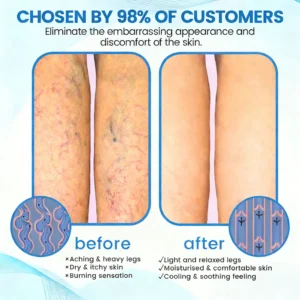 GFOUK® VascuCare Vein Healing Spray
