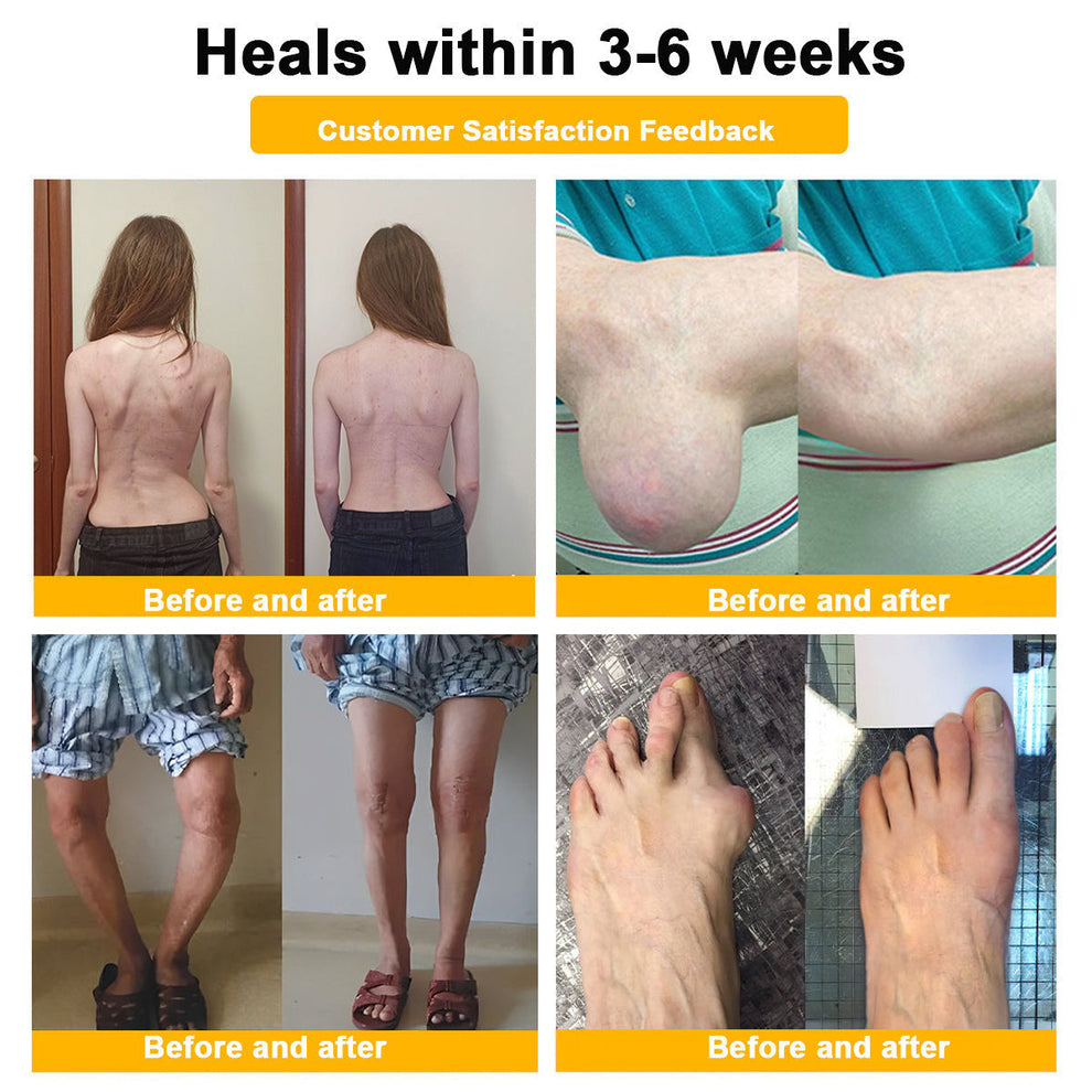 Purelora® Bee Venom Pain Relief Joint Repair Cream image Purelora® Bee Venom Pain Relief Joint Repair Cream