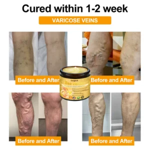 Cougex® Bee Venom Advanced Joint and Bone Healing Cream image Cougex® Bee Venom Advanced Joint and Bone Healing Cream