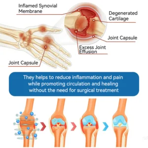 Croaie® B.P.C-157 Joint Healing Cream image Croaie® B.P.C-157 Joint Healing Cream