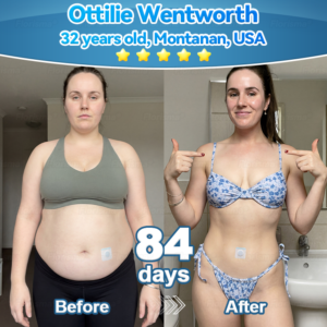 Florisma® Plant-Derived Cellular Support Complex Patch