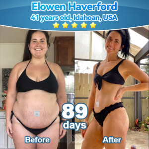 Florisma® Plant-Derived Cellular Support Complex Patch