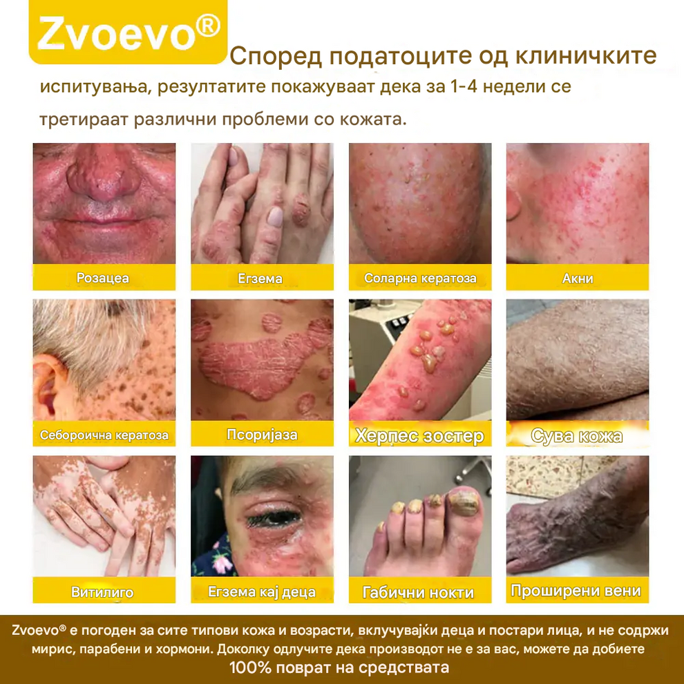 Zvoevo Royal Jelly Skin Spray