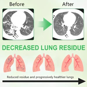 GFOUK® 3X Concentrated Mullein Lung Cleanse Spray image GFOUK® 3X Concentrated Mullein Lung Cleanse Spray