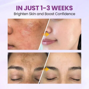 Biancat® RadiantClear Blemish & Brightening Serum