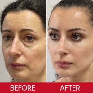 LIMETOW® Retinol Eye Stick