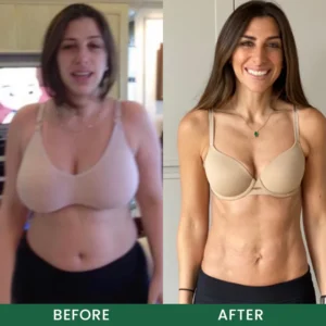 LIMETOW® Ultimate Detox Patch