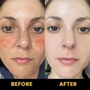 LIMETOW™ Propolis Moisturizing and Repairing Essence Stick image LIMETOW™ Propolis Moisturizing and Repairing Essence Stick