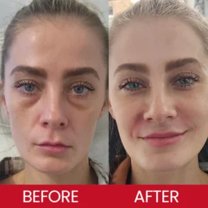 LIMETOW® Retinol Eye Stick