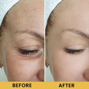 LIMETOW® Wild Ginseng Anti-Aging Essence