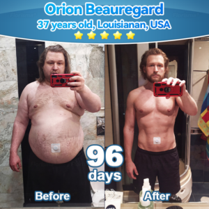 Florisma® Plant-Derived Cellular Support Complex Patch