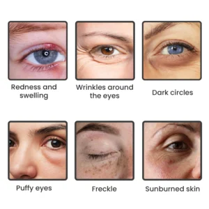 LIMETOW™ Instant Eye Cream Tightener