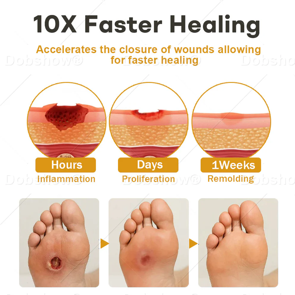 Healrize® GlucoShield Bee Venom Wound Spray image Healrize® GlucoShield Bee Venom Wound Spray